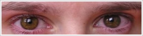 Acuvue 2 Colours - krycí / Medová -