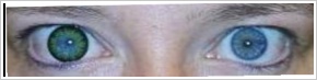 ColourVUE Big Eyes / Party green - 