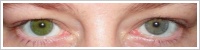 Focus SoftColors / Evergreen -