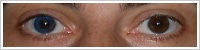 Acuvue 2 Colours - krycí / Modrá -